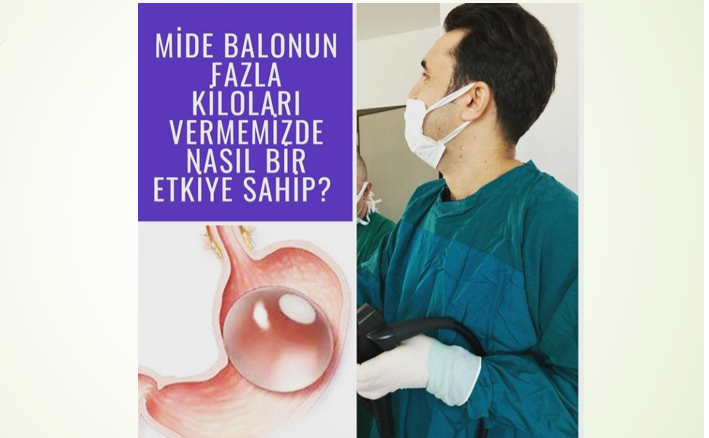 Mide Balonu obezite için cerrahi olmayan tedavi seçeneklerinden biridir